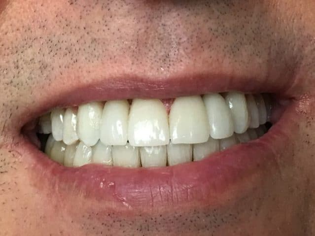 dental after photo