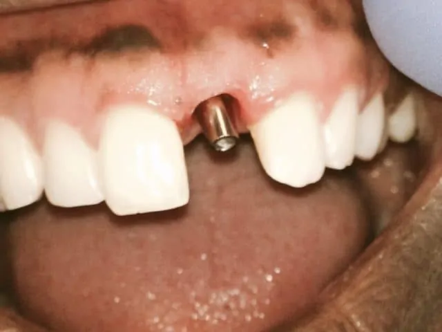 dental before photo