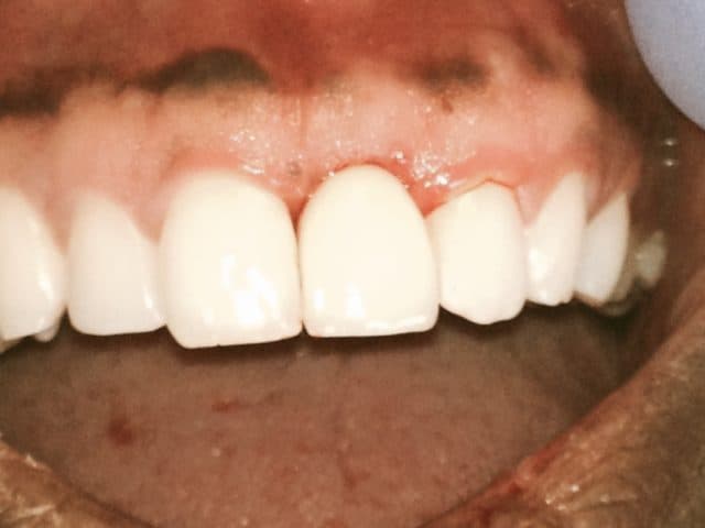dental after photo