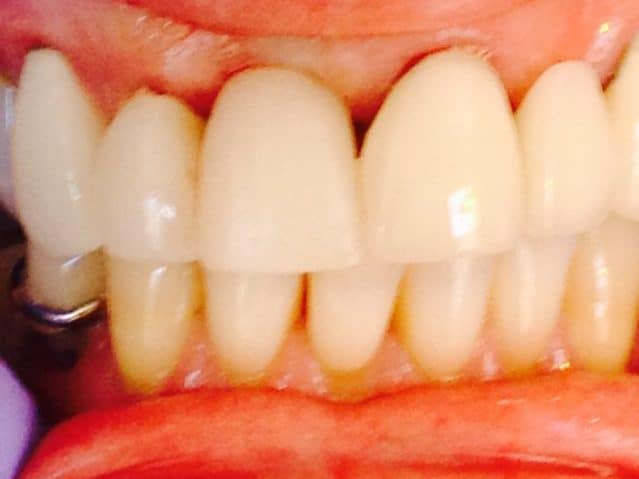 dental after photo